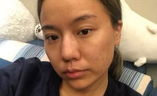 网红邢晓瑶整容前后,蜕变之路，美丽重生